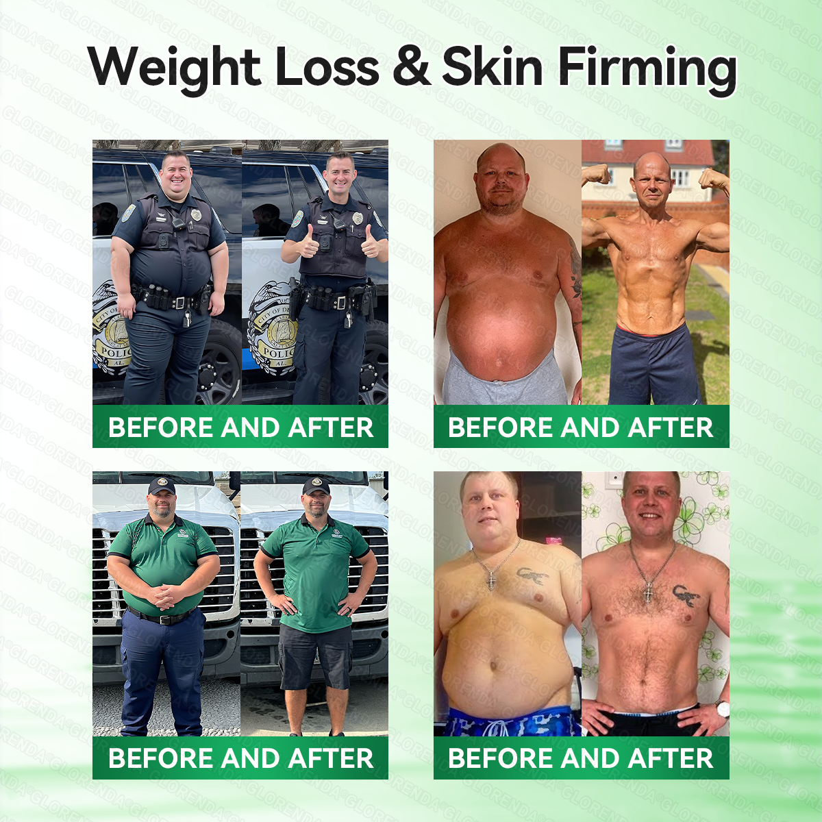 CA 𝑶𝒇𝒇𝒊𝒄𝒊𝒂𝒍 𝑺𝒕𝒐𝒓𝒆 |🍁🍁𝐂𝐚𝐫𝐞𝐔𝐩𝐥𝐢𝐟𝐭® 𝙈𝒐𝒓𝒊𝒏𝒈𝗮 · 𝗕𝗲𝗿𝗯𝐞𝐫𝐢𝐧𝙚 × 𝙉𝑨𝑫+ 𝟏𝟎-𝙞𝙣-𝟏 𝘼𝒅𝒗𝒂𝒏𝒄𝒆𝐝 𝐍𝐚𝐧𝙤 𝙈𝙞𝙘𝙧𝙤𝙣𝒆𝒆𝒅𝒍𝐞 𝐏𝐚𝐭𝙘𝙝(𝐉𝐮𝐬𝐭 𝐨𝐧𝐜𝐞 𝐚 𝐝𝐚𝐲,𝐯𝐢𝐬𝐢𝐛𝐥𝐞 𝐜𝐡𝐚𝐧𝐠𝐞𝐬 𝐢𝐧 𝟕 𝐝𝐚𝐲𝐬）✅𝐅𝐨𝐫 𝐨𝐛𝐞𝐬𝐢𝐭𝐲,🅛🅞🅞🅢🅔 🅢🅚🅘🅝,𝐝𝐢𝐚𝐛𝐞𝐭𝐞𝐬,𝐬𝐥𝐞𝐞𝐩 𝐚𝐩𝐧𝐞𝐚,𝐣𝐨𝐢𝐧𝐭 𝐢𝐬𝐬𝐮𝐞𝐬,𝐚𝐧𝐝 𝐦𝐨𝐫𝐞
