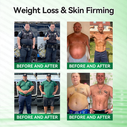 CA 𝑶𝒇𝒇𝒊𝒄𝒊𝒂𝒍 𝑺𝒕𝒐𝒓𝒆 |🍁🍁𝐂𝐚𝐫𝐞𝐔𝐩𝐥𝐢𝐟𝐭® 𝙈𝒐𝒓𝒊𝒏𝒈𝗮 · 𝗕𝗲𝗿𝗯𝐞𝐫𝐢𝐧𝙚 × 𝙉𝑨𝑫+ 𝟏𝟎-𝙞𝙣-𝟏 𝘼𝒅𝒗𝒂𝒏𝒄𝒆𝐝 𝐍𝐚𝐧𝙤 𝙈𝙞𝙘𝙧𝙤𝙣𝒆𝒆𝒅𝒍𝐞 𝐏𝐚𝐭𝙘𝙝(𝐉𝐮𝐬𝐭 𝐨𝐧𝐜𝐞 𝐚 𝐝𝐚𝐲,𝐯𝐢𝐬𝐢𝐛𝐥𝐞 𝐜𝐡𝐚𝐧𝐠𝐞𝐬 𝐢𝐧 𝟕 𝐝𝐚𝐲𝐬）✅𝐅𝐨𝐫 𝐨𝐛𝐞𝐬𝐢𝐭𝐲,🅛🅞🅞🅢🅔 🅢🅚🅘🅝,𝐝𝐢𝐚𝐛𝐞𝐭𝐞𝐬,𝐬𝐥𝐞𝐞𝐩 𝐚𝐩𝐧𝐞𝐚,𝐣𝐨𝐢𝐧𝐭 𝐢𝐬𝐬𝐮𝐞𝐬,𝐚𝐧𝐝 𝐦𝐨𝐫𝐞